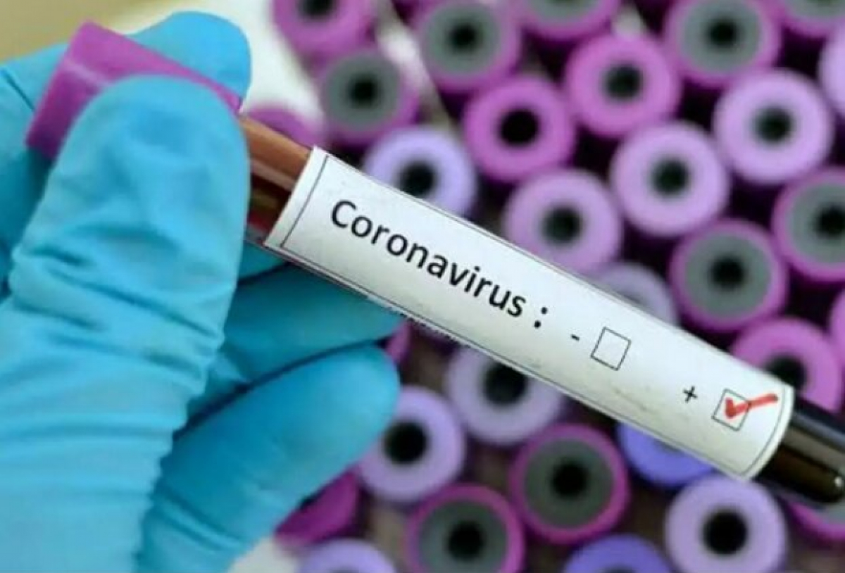 Летальный случай от COVID-19 в ВСУ – экспресс-тест не подтвердил коронавирус