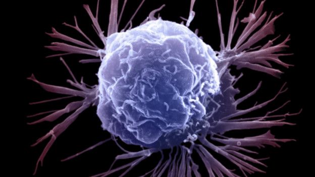 Ученые намерены излечивать рак методом "ахиллесовой пяты": раскрыт инновационный способ