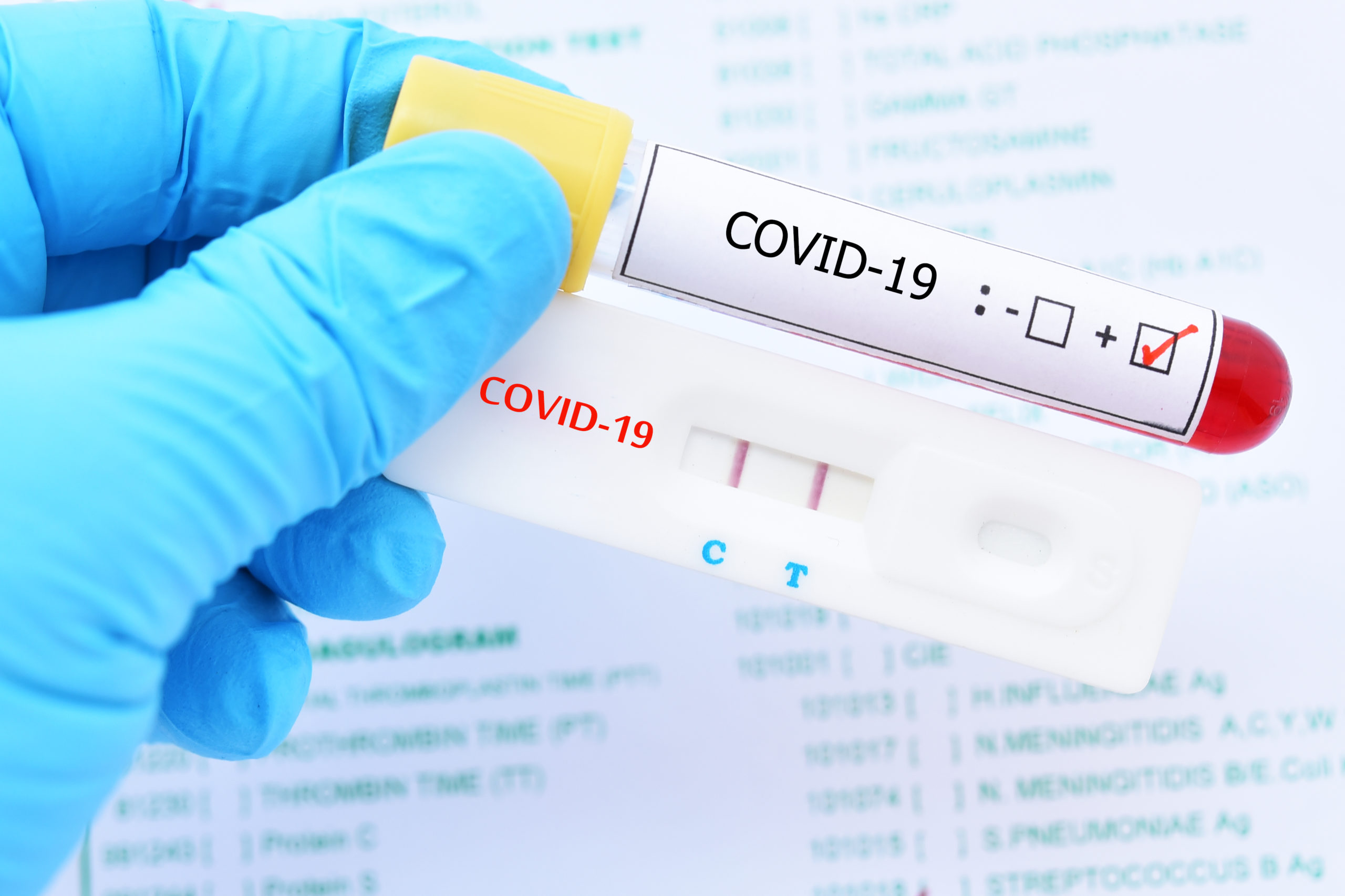 В Украине заболеваемость коронавирусом держится на высоком уровне - данные на 5 октября 
