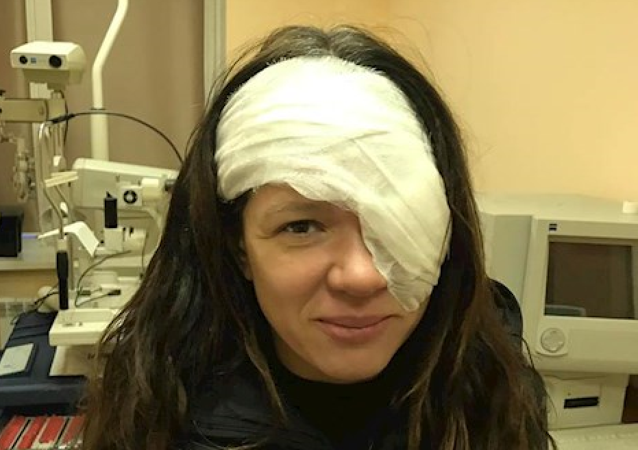 Срочная операция на лице певицы Русланы: артистка впервые рассказала о диагнозе - кадры