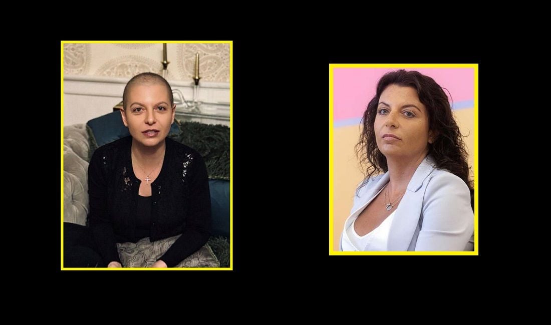 Облысевшая ​Симоньян впервые показала себя без парика: после химиотерапии у нее выпали волосы