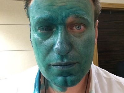 "После атаки зеленкой мой глаз потерял 80% зрения...", - Навальный шокировал чудовищными последствиями нападения и рассказал о новой подлости властей России против него