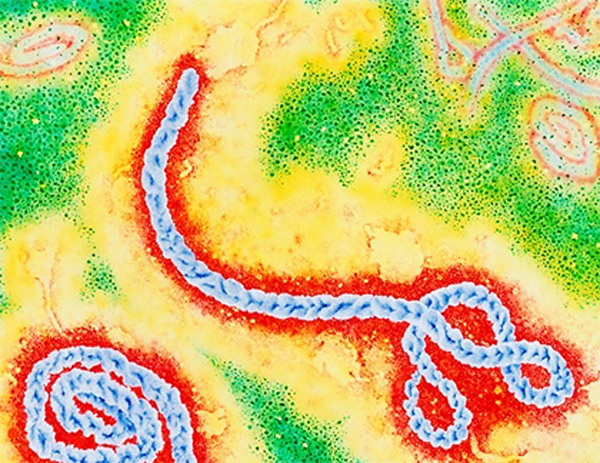 В ООН считают, что до конца 2015 года вакцина против Эболы получит массовое распространение 
