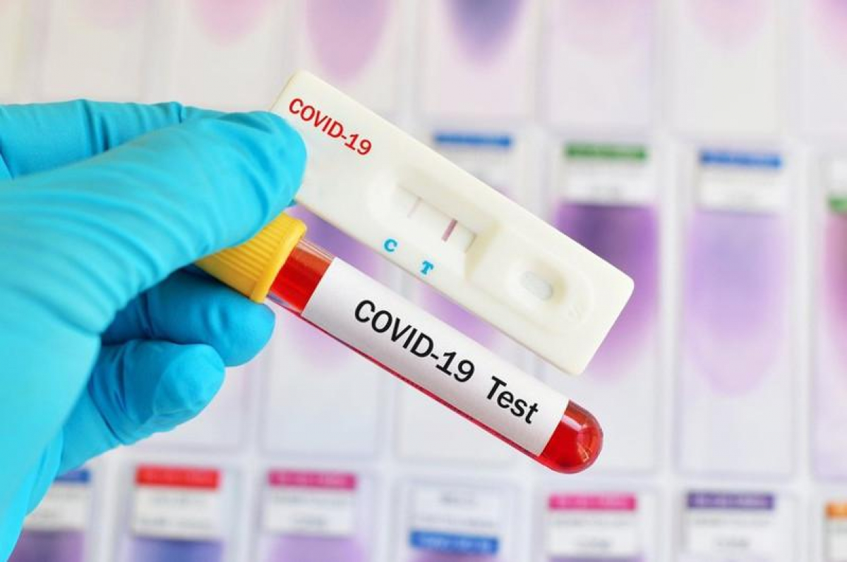 В Украине ​число инфицированных COVID-19 приближается в 32 тысячам - данные на 15 июня 
