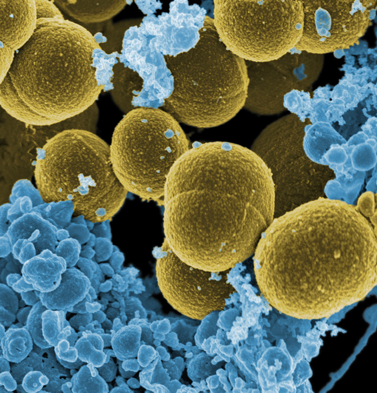 Ученые: открыт новый вид антибиотика, позволяющий бороться с неуязвимыми бактериями