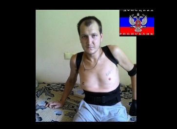 "Помогите, срочно нужна помощь!!" - боевик "ДНР" с ампутированной рукой после ранения на Донбассе просит о помощи, собирая деньги на срочное лечение