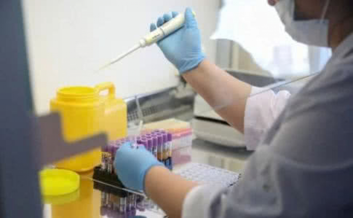 "Украинский прорыв" тест-системы коронавируса уже в лабораториях: НАН Украины передала первые партии