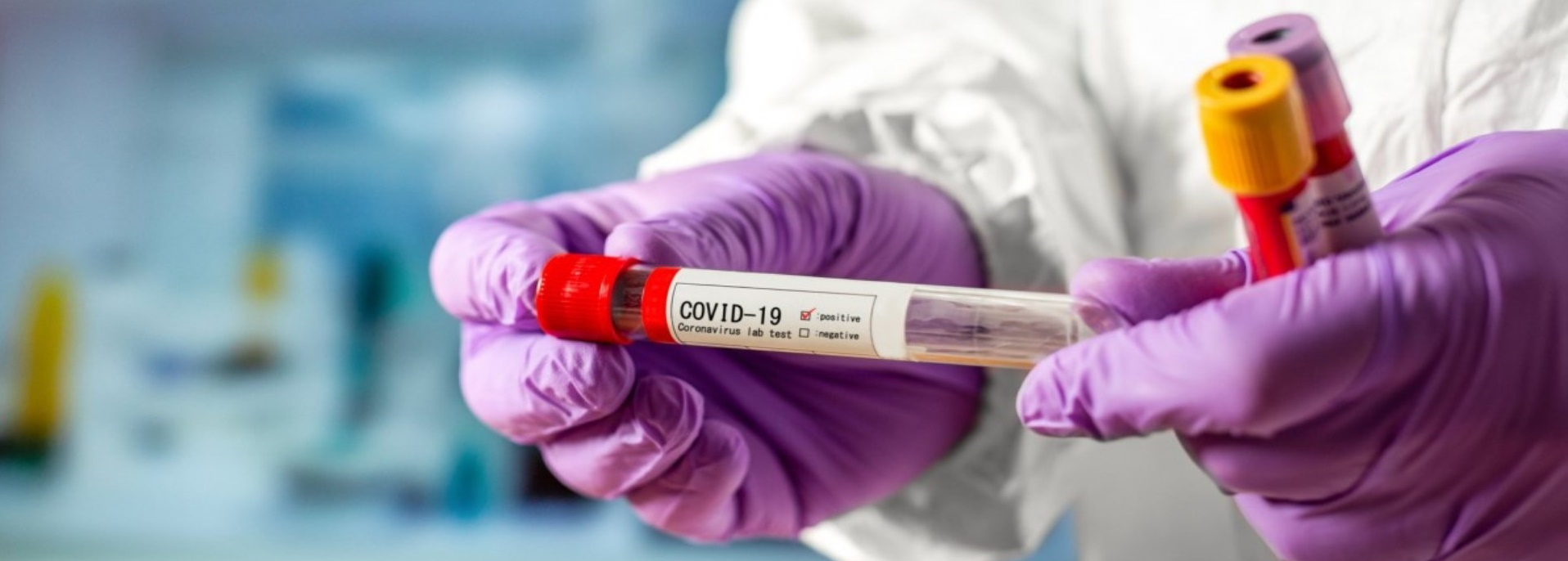 В Украине можно будет пройти бесплатный тест на COVID-19: озвучены условия