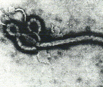 В Калифорнии зафиксирован пациент с симптомами вируса Эбола