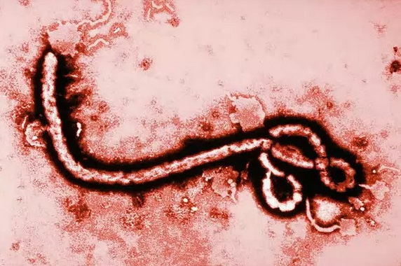 ВОЗ: вирус Эбола унес жизни 8 тыс. человек на западе Африки 