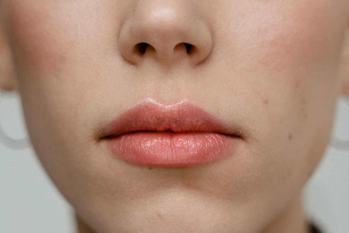 Почему сохнут губы: названы причины и способы борьбы с проблемой