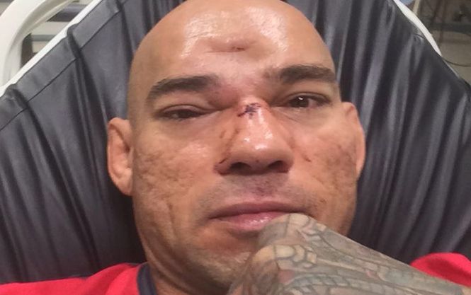 Боксеру из Бразилии проломили череп на ринге: видео