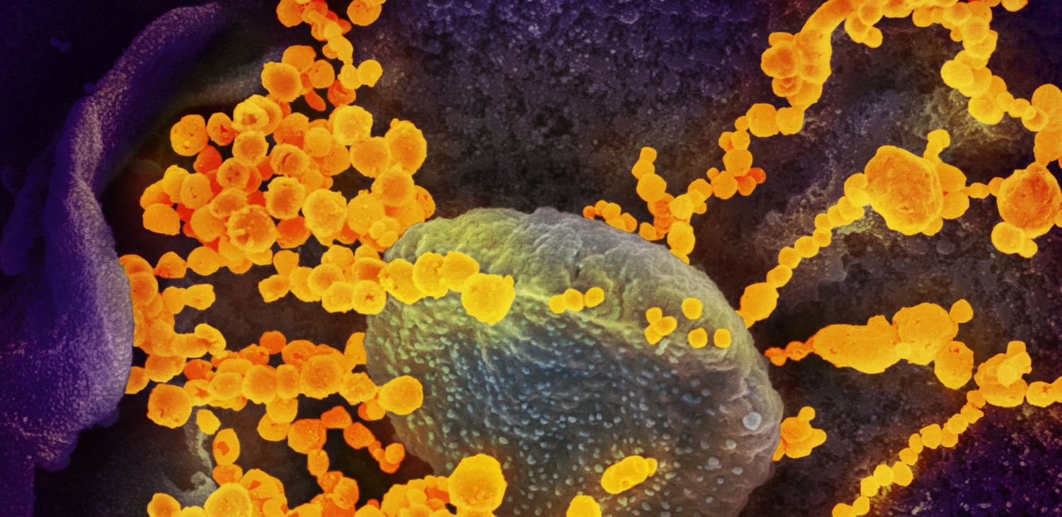 "Впереди сложное время", – ученые из Германии пояснили, сколько продлится пандемия коронавируса
