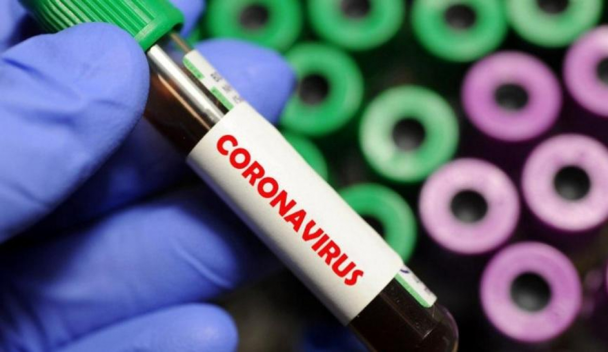 Журналистку "Левого берега" госпитализировали с подозрением на коронавирус, детали