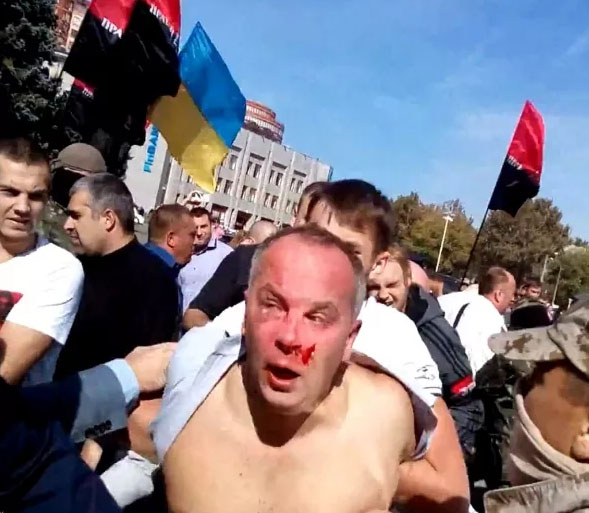 Как радикалы избивали народного депутата Нестора Шуфрича под зданием Одесской ОГА