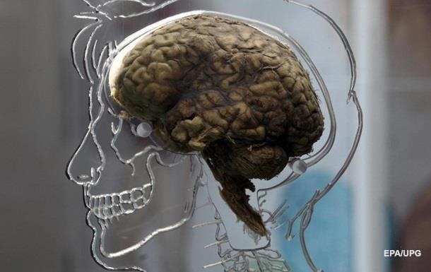 Жизнь после смерти: ученые США готовы оживить мертвый мозг человека