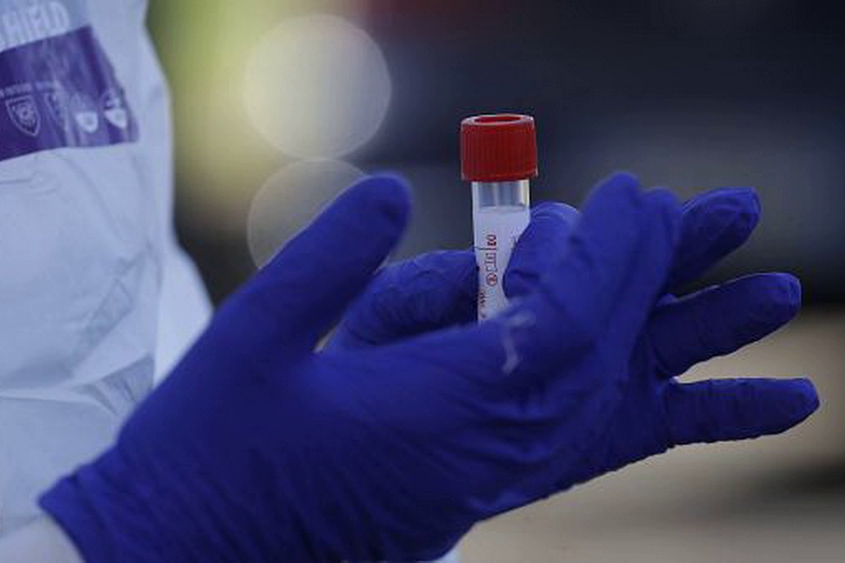 ​The Times: вирус, похожий на SARS-CoV-1, хранился в лаборатории Ухани 8 лет до пандемии