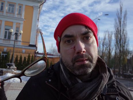 Радикалы избили канадского репортера на марше в поддержку трансгендеров в Киеве