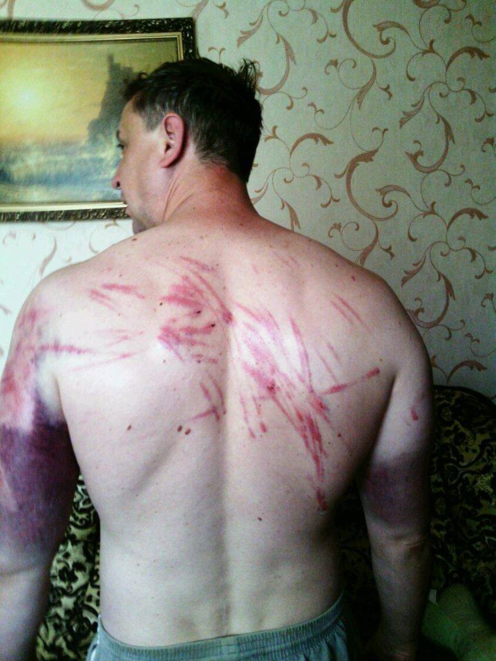 Боевики избивали донецкого пастора 8 часов из-за фото возле памятника Бандере