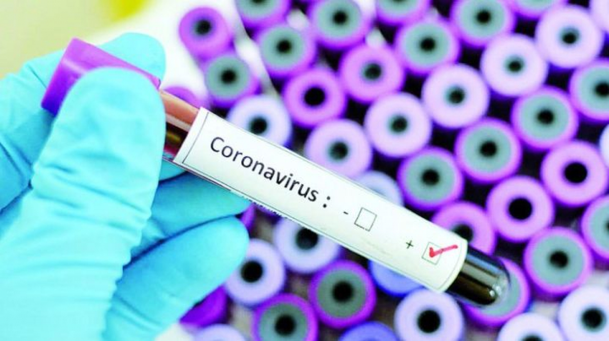 В Украине 3-й день более 800 новых случаев коронавируса - статистика на 17 июля 