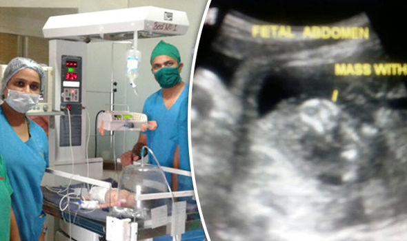 Беременный новорожденный – шокирующие кадры