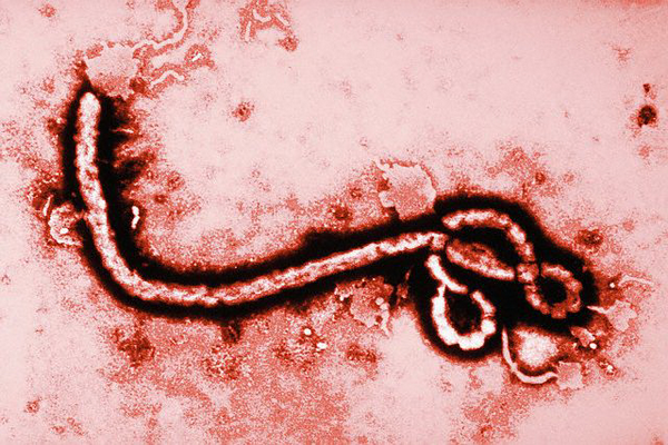 От лихорадки Эбола скончался житель Саудовской Аравии