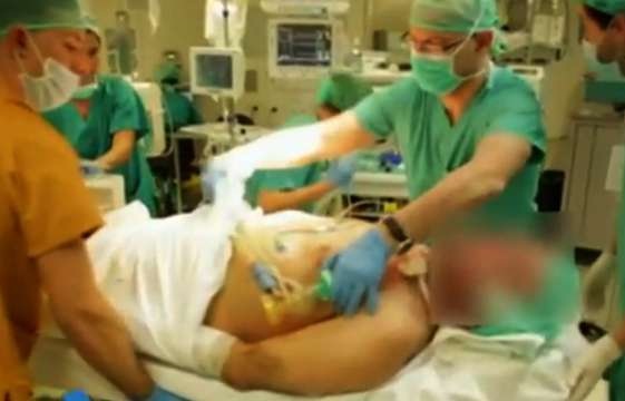 В испанской клинике врачи впервые пересадили голову человеку