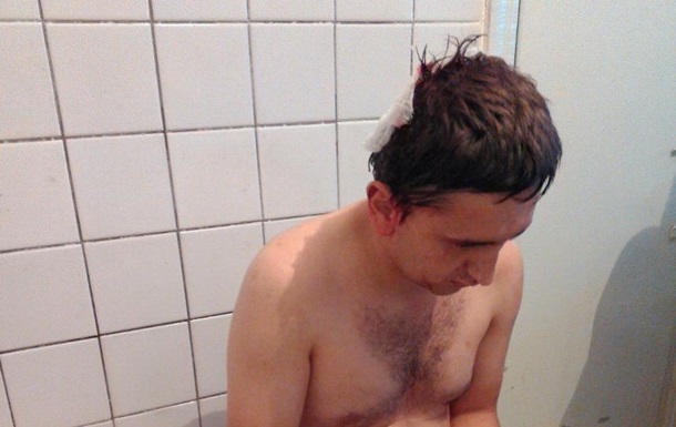 На Житомирщине избит журналист, боровшийся с "янтарной мафией"