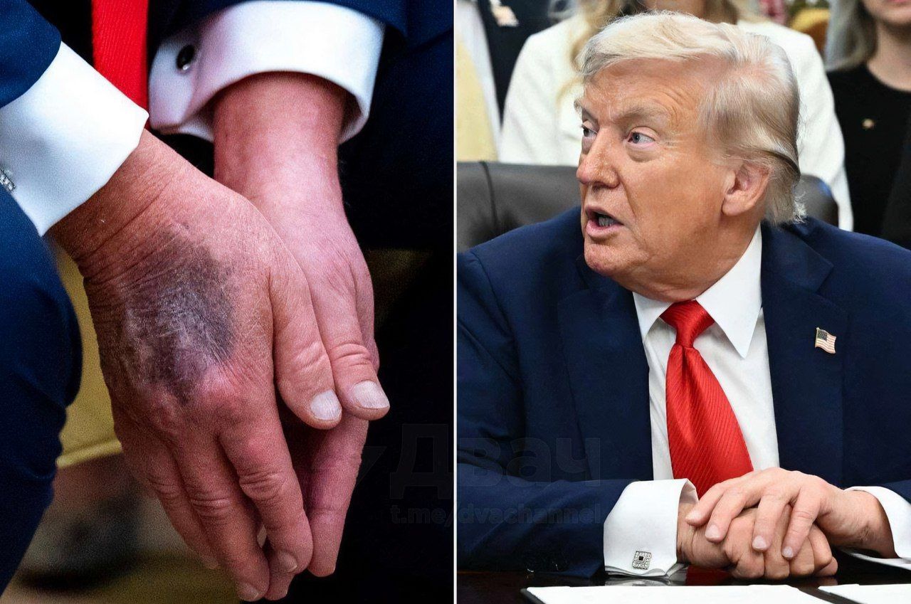 "Трамп мертв", - в американских соцсетях "хоронят" президента США, фраза массово вышла в топ "Твиттера"