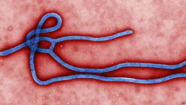 Шведские врачи проверяют пациента с подозрением на вирус лихорадки Эбола
