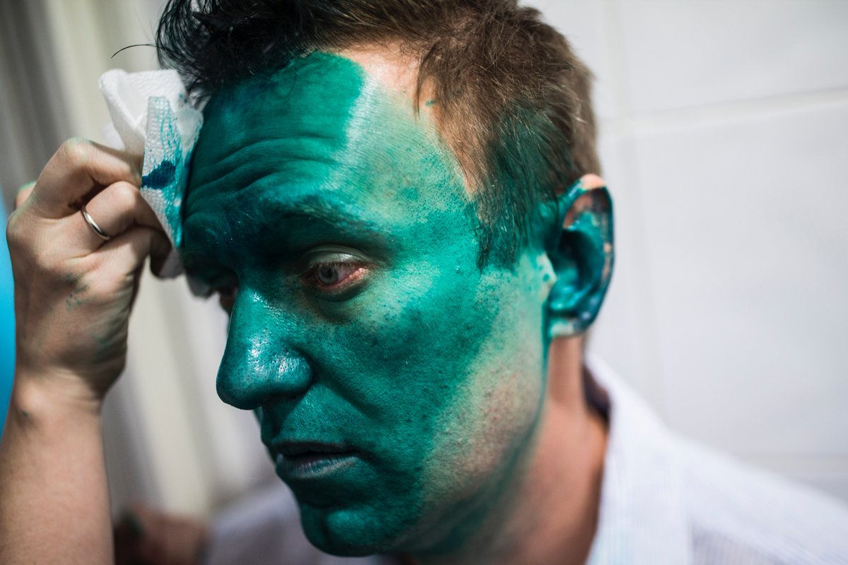 Российский пропагандистский телеканал опубликовал видео, как Навального обливают зеленкой