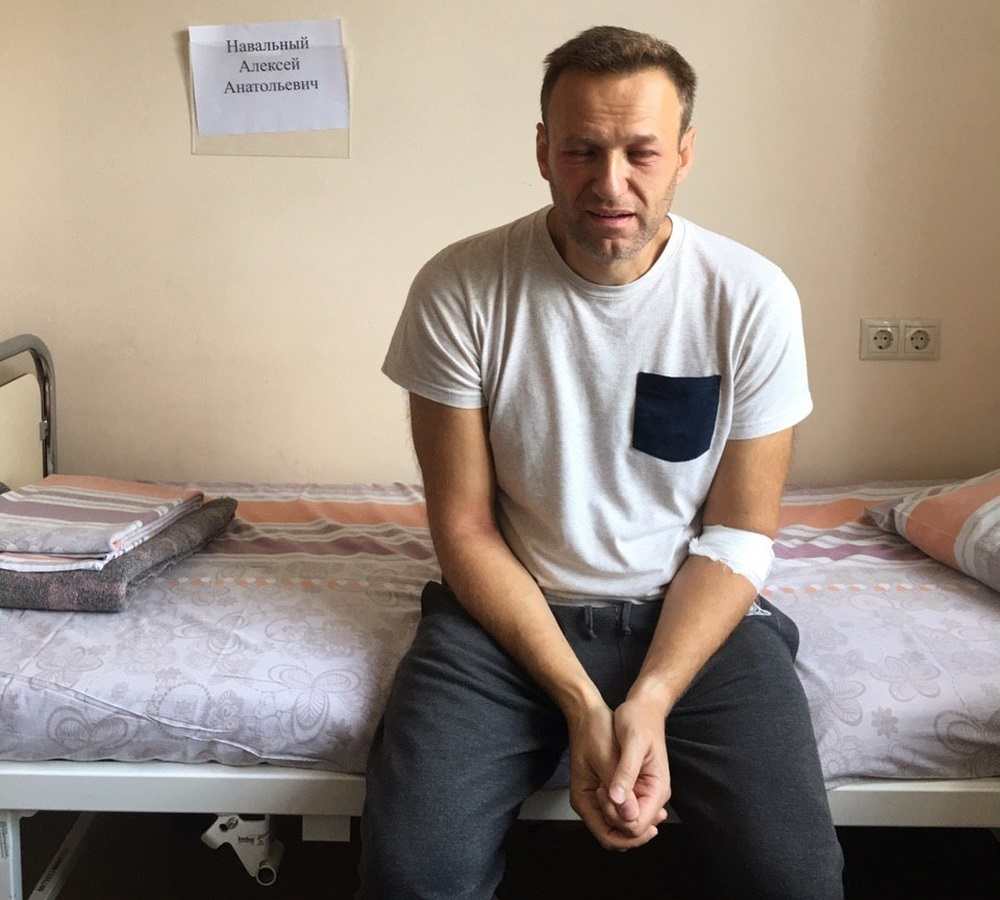 Навальный смог подняться с постели: клиника "Шарите" сделала заявление о произошедшем в Берлине