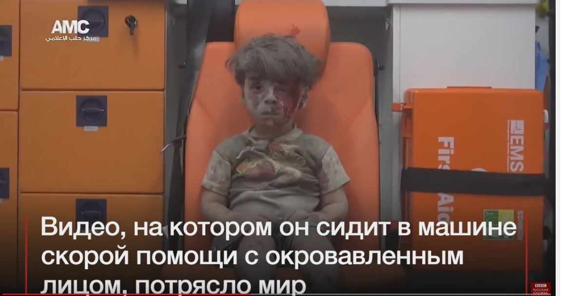 Видео раненного после российской бомбежки мальчика потрясло весь мир: маленький Омран Дакнеш назван "символом Сирийской войны" (кадры)