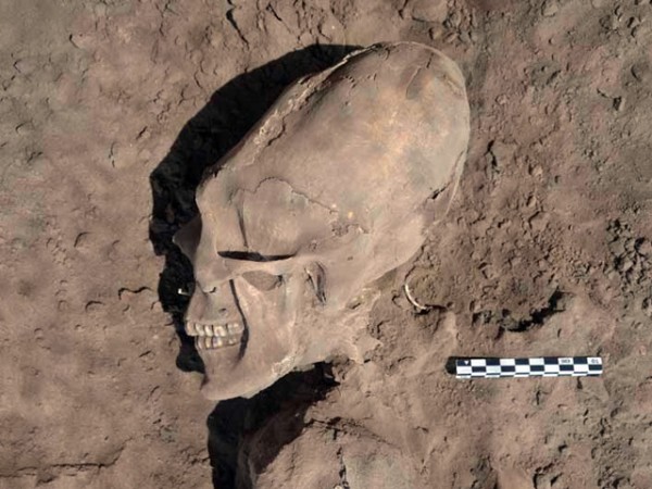 Люди или сверхлюди: в Приэльбрусье нашли шокирующие черепа неизвестных существ