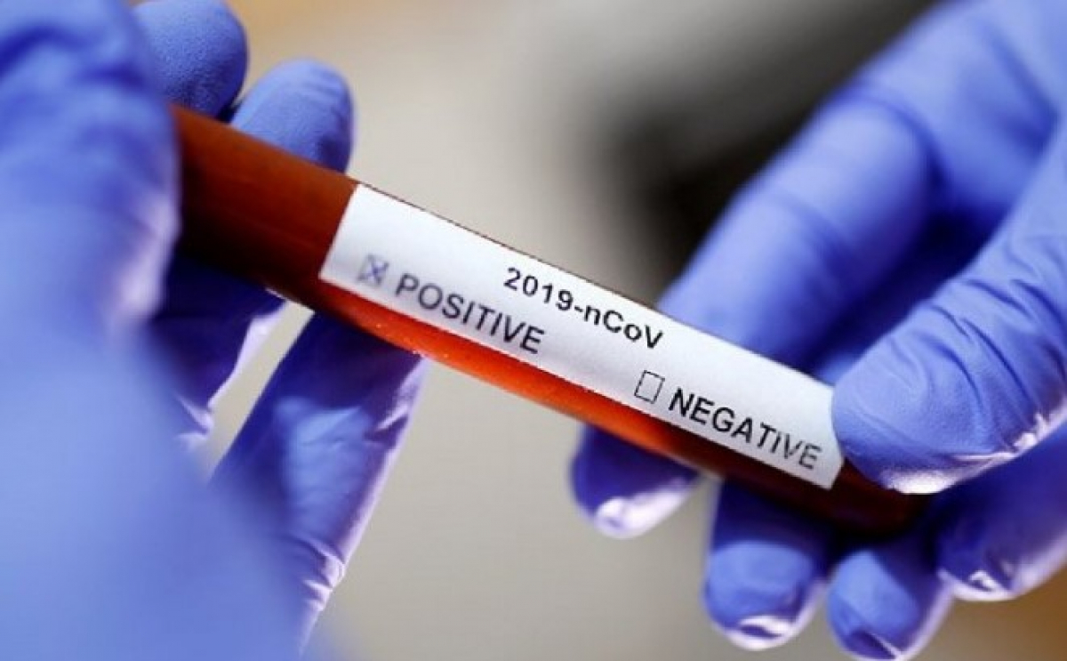 Хроника пандемии коронавируса в Запорожской области: +4 заболевших и 1 смерть - данные на 14 апреля 