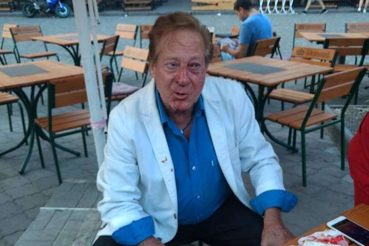"Полицию ждали почти час", - в Одессе побили 73-летнего американского артиста Билла Уоррена