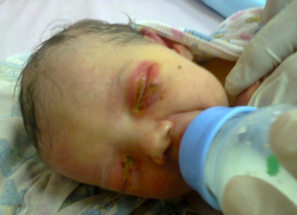 В Челябинске заживо закопанный младенец почти сутки пролежал в земле и выжил