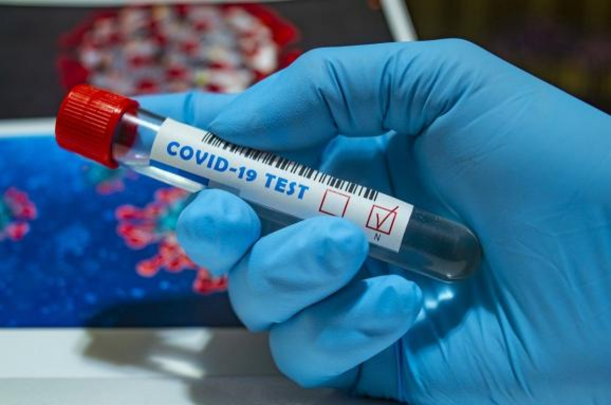 В Украине за сутки более 1 600 новых случаев коронавируса - данные на 18 августа