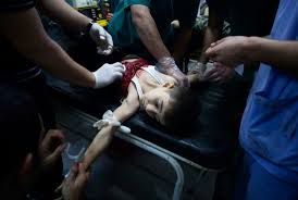 Страшные кадры из Сирии. Российская авиация убивает детей