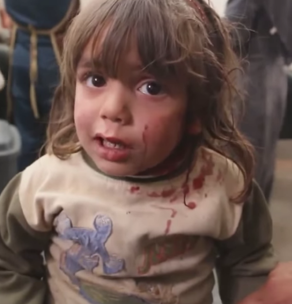 Очередные последствия кровавой политики Путина в Сирии: разрушенные города и раненные дети 