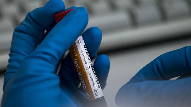 Если хакерская атака спецслужб РФ на WADA подтвердится, то российские спортсмены навсегда будут отстранены от участия во всех соревнованиях – Зеппельт