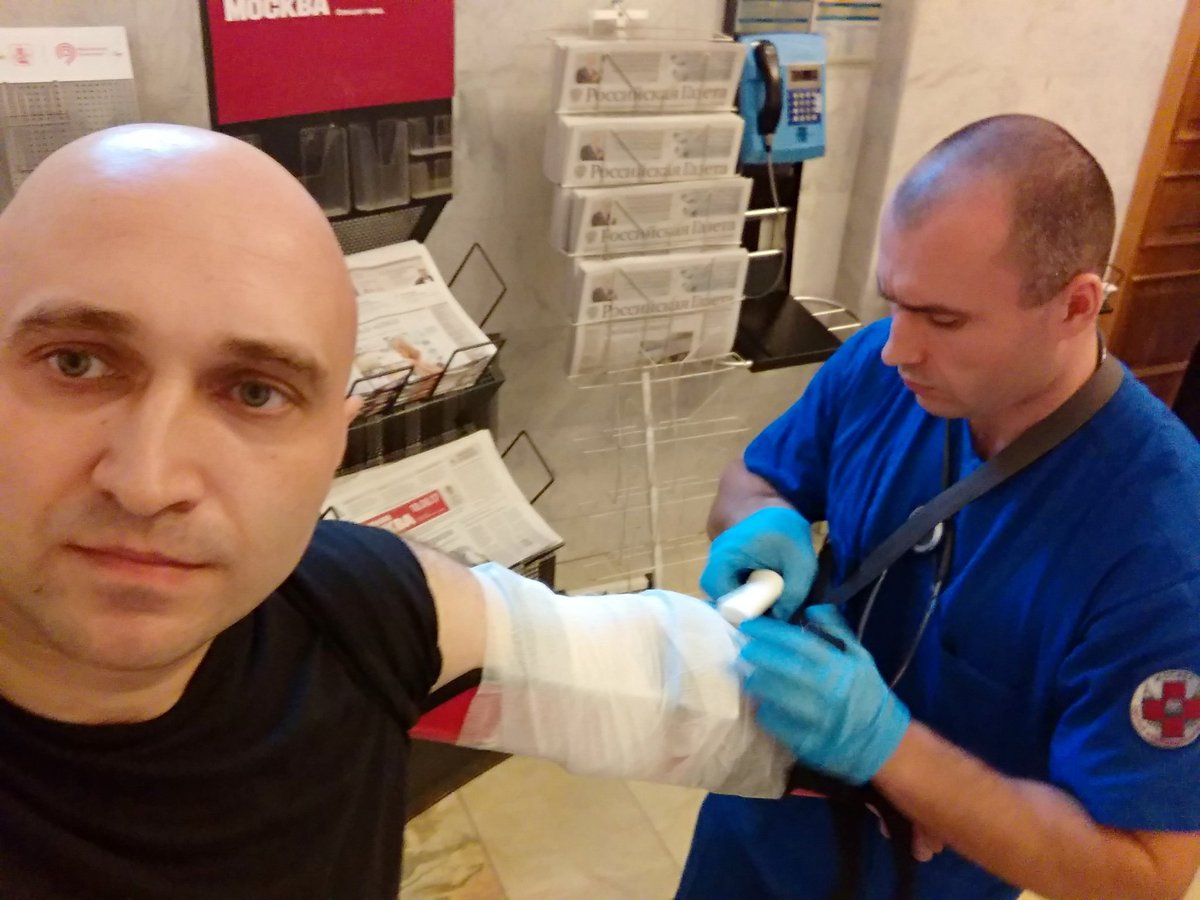 "Мне сломали руку за то, что я припарковался на месте Собянина", - охрана мэрии Москвы искалечила мужчину, опубликованы шокирующие кадры 