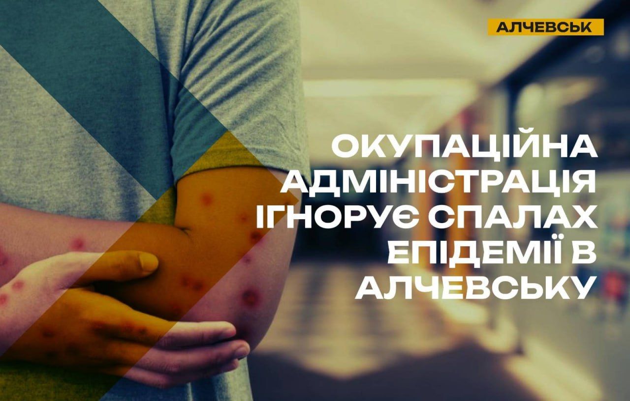 В Алчевске массово распространяется заразная инфекция, но оккупационные власти игнорируют угрозу – ЦНС
