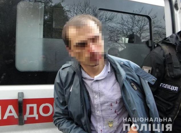 Кража в Киеве 800 тысяч гривен: свидетели заблокировали авто нападавших - фото пойманного вора