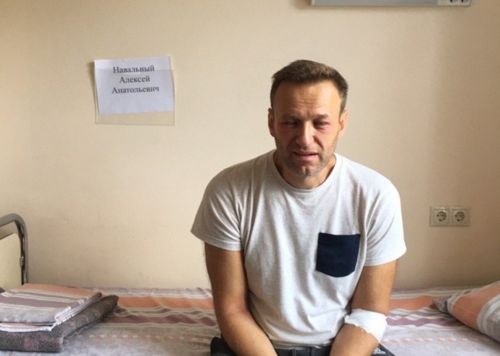 Фото измученного Навального "взорвало" Сеть: оппозиционер выжил после "аллергии" и назвал отравителей