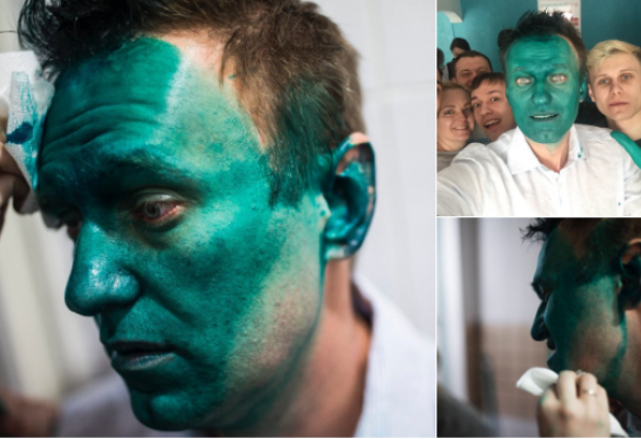На Навального совершили очередное нападение и облили зеленкой: СМИ опубликовали видео и неожиданную реакцию в соцсетях