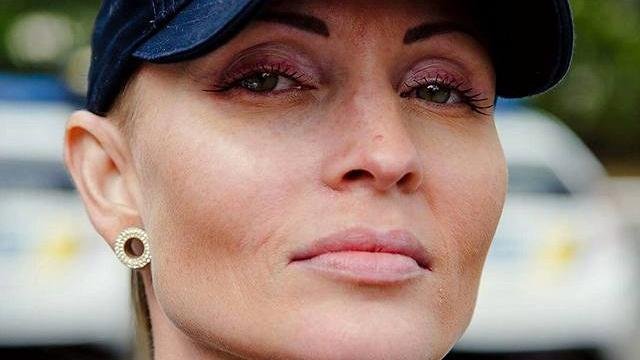 Смерть полицейской породила вопрос: может ли человек заразиться туберкулезом от плевка? Отвечает врач