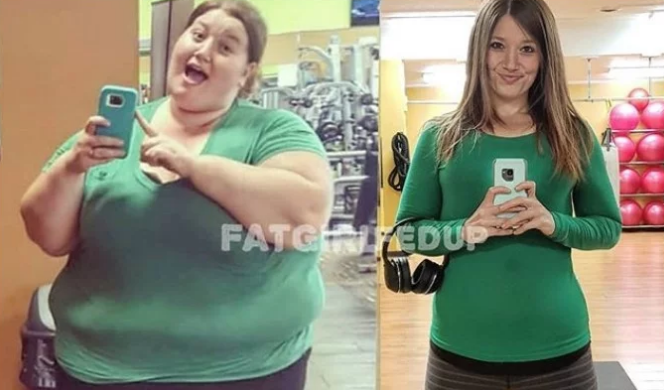 Пышка стала худышкой: девушка сбросила 140 кг, но результат сделал ее несчастной – кадры не для слабонервных 
