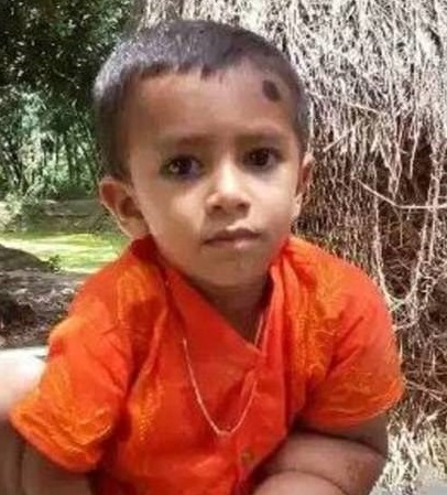 При виде пятилетнего Тайбира из Бангладеш, родители в страхе прячут своих детей по домам: из-за тяжелого недуга ребенка прозвали "маленьким дьяволом", - кадры