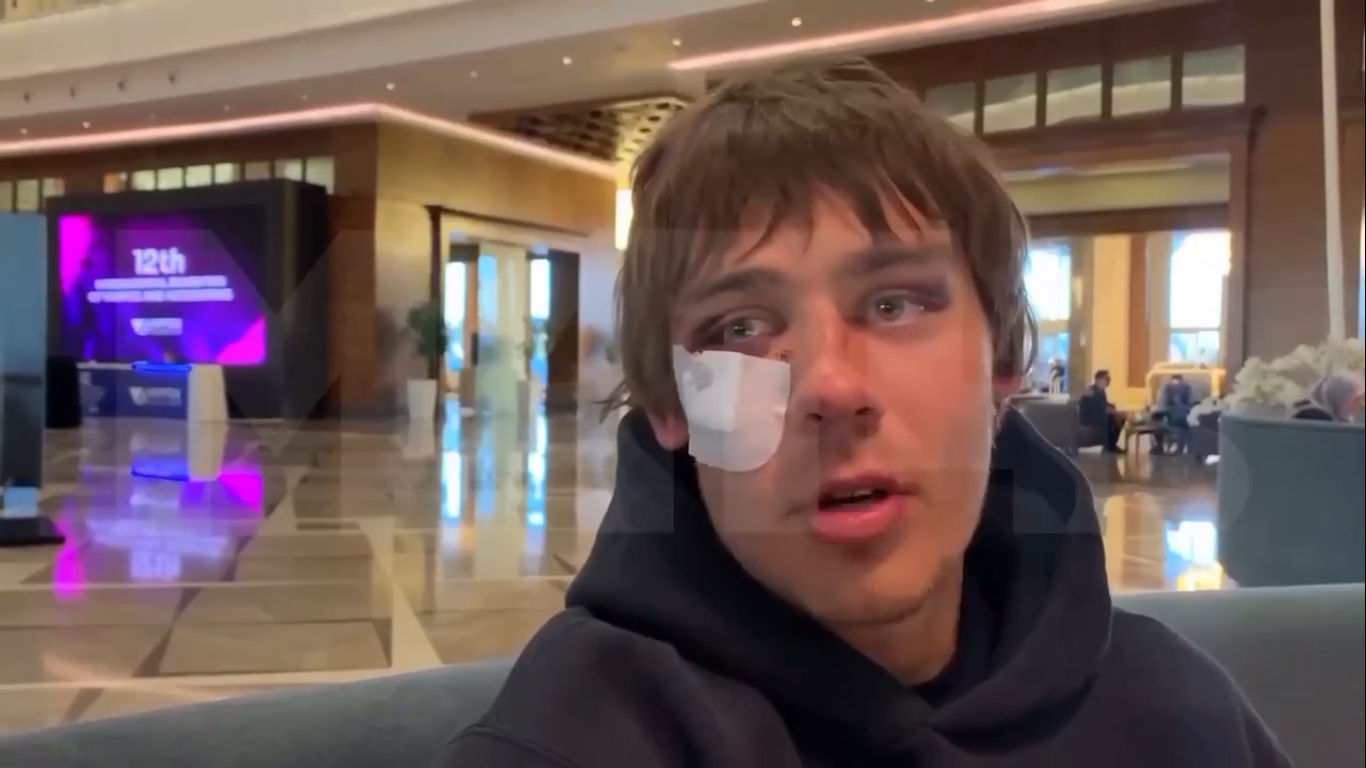 ​Игрок "Шинника" с подбитым глазом озвучил свое версию драки с украинскими футболистами в отеле Турции
